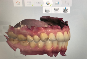 A digital image of the inside of someone's mouth