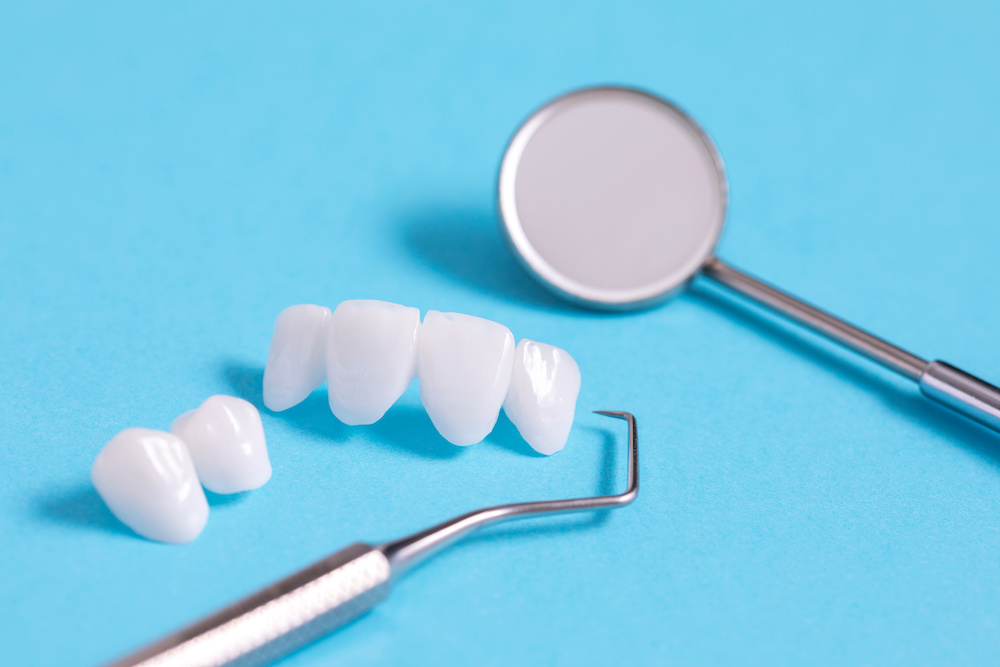 Zircon dentures samples on a blue sheet with dental tools - Ceramic veneers - lumineers